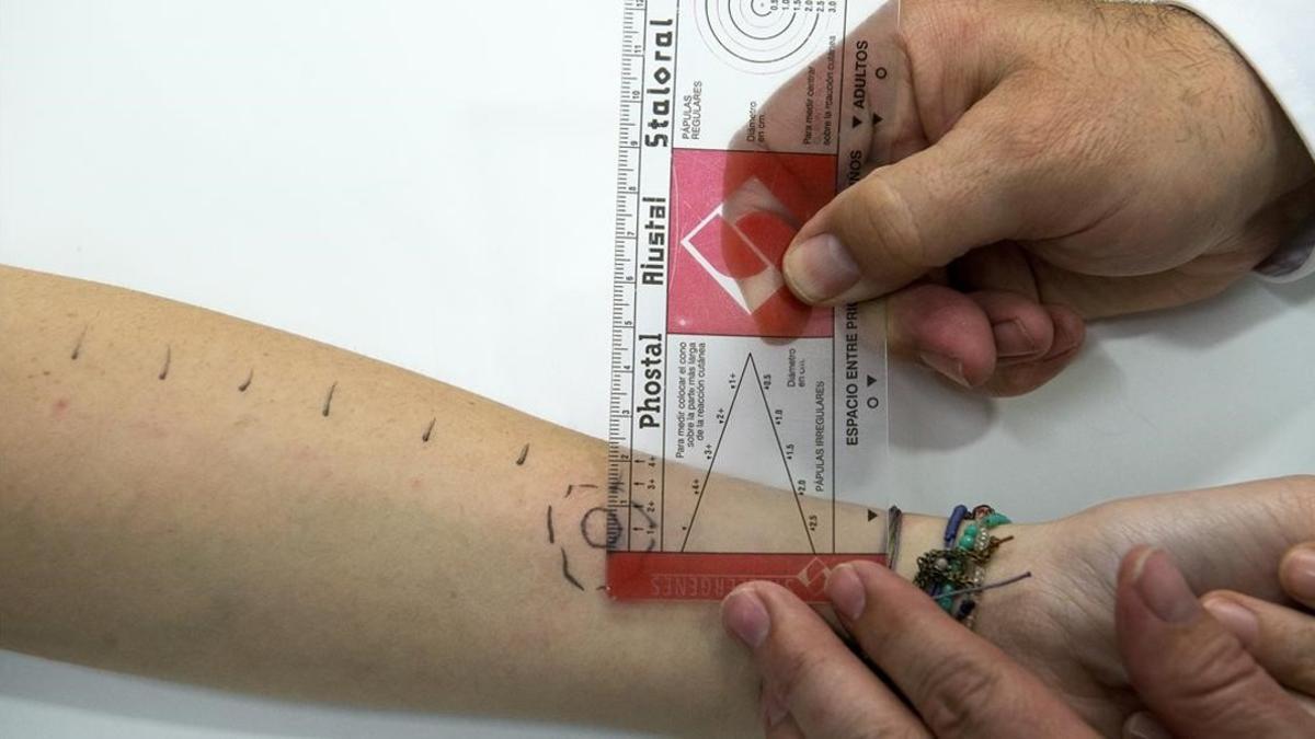 Un alergólogo realiza una prueba de alergia en la piel a una paciente.