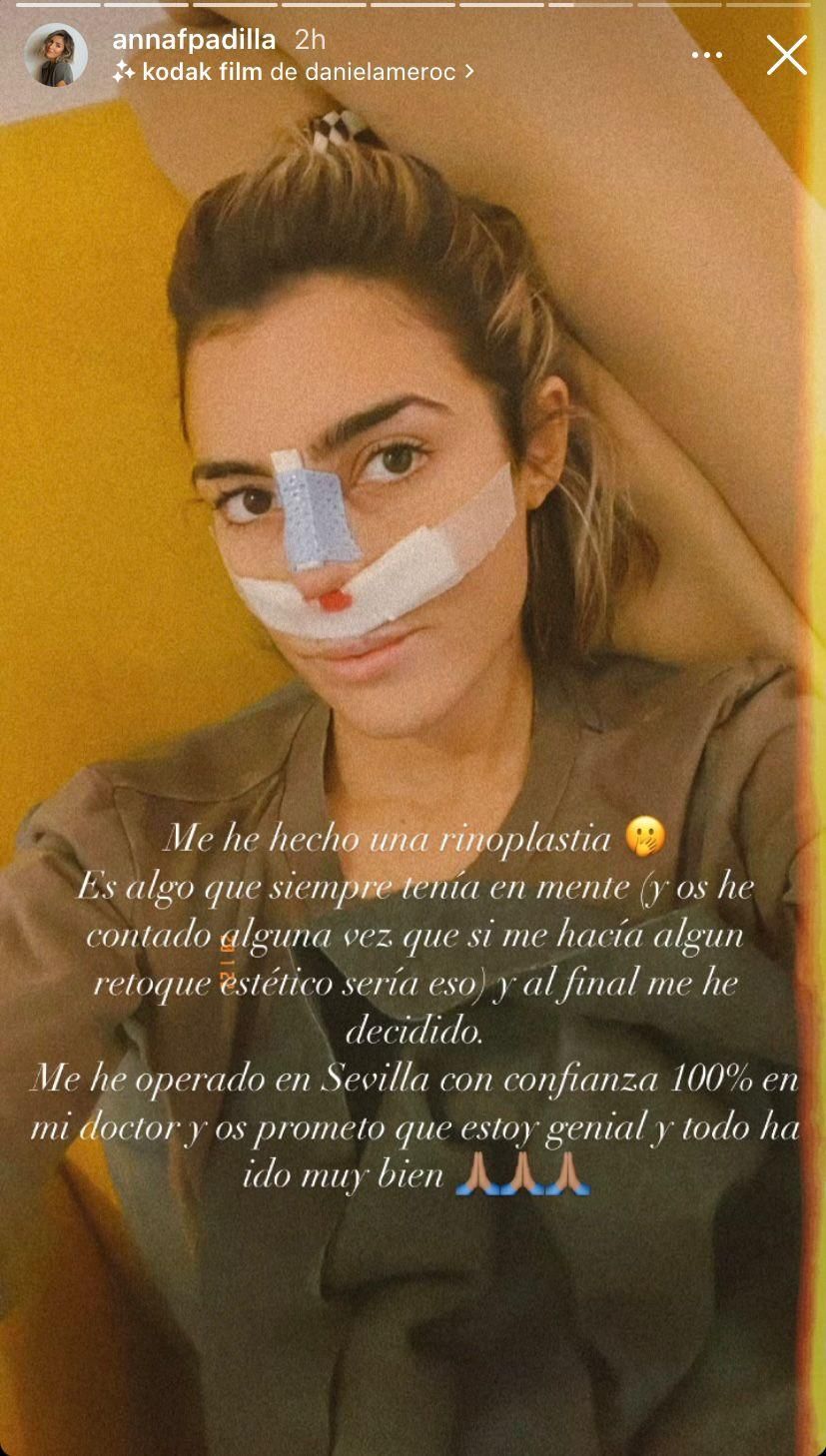 Anna Padilla se somete a una rinoplastia