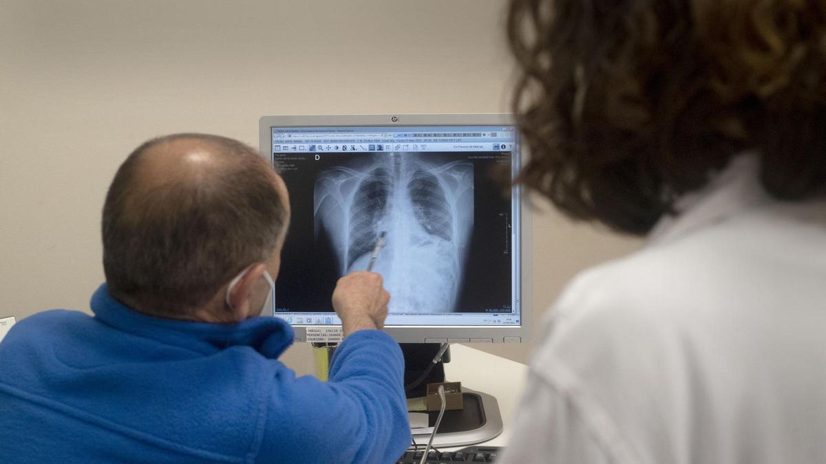 Un par de especialistas torácicos consultan el resultado de una prueba en el hospital la Fe.