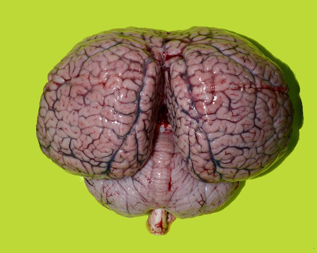 Cerebro de un cetáceo