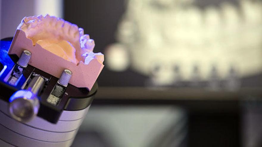 iDental implanta tecnología avanzada con su impresora digital 3D