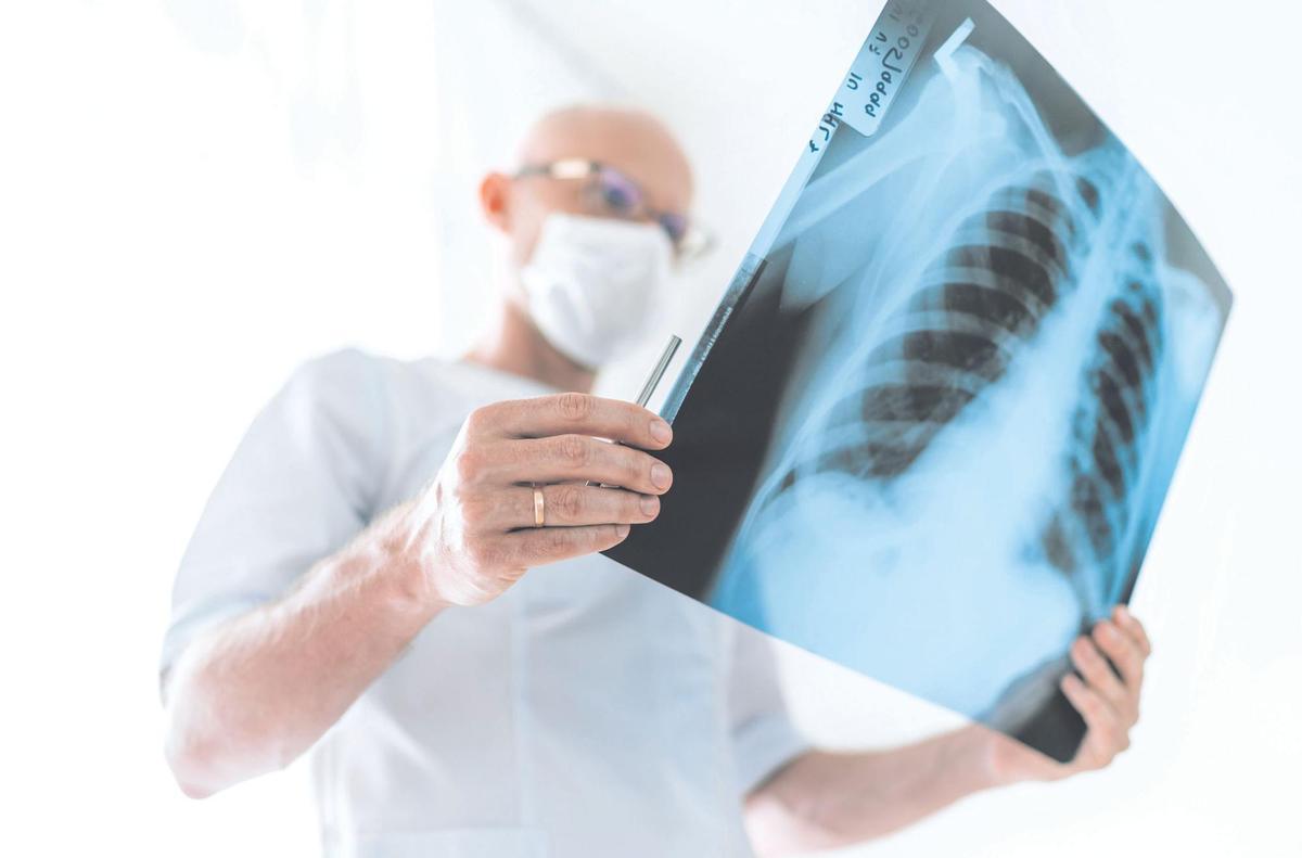 El 60% de enfermos de cáncer recibir radioterapia en algún momento de su enfermedad.
