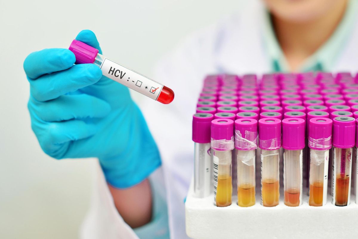 Més de 1.000 pacients amb hepatitis C, sense tractament pel col·lapse a l’Atenció Primària Més de 1.000 pacients amb hepatitis C, sense tractament pel col·lapse a l’Atenció Primària