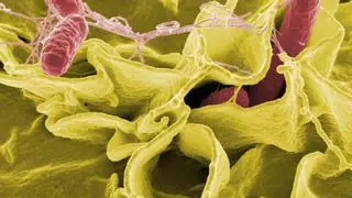 Alerta alimentaria: presencia de Salmonella en estas marcas de torreznos