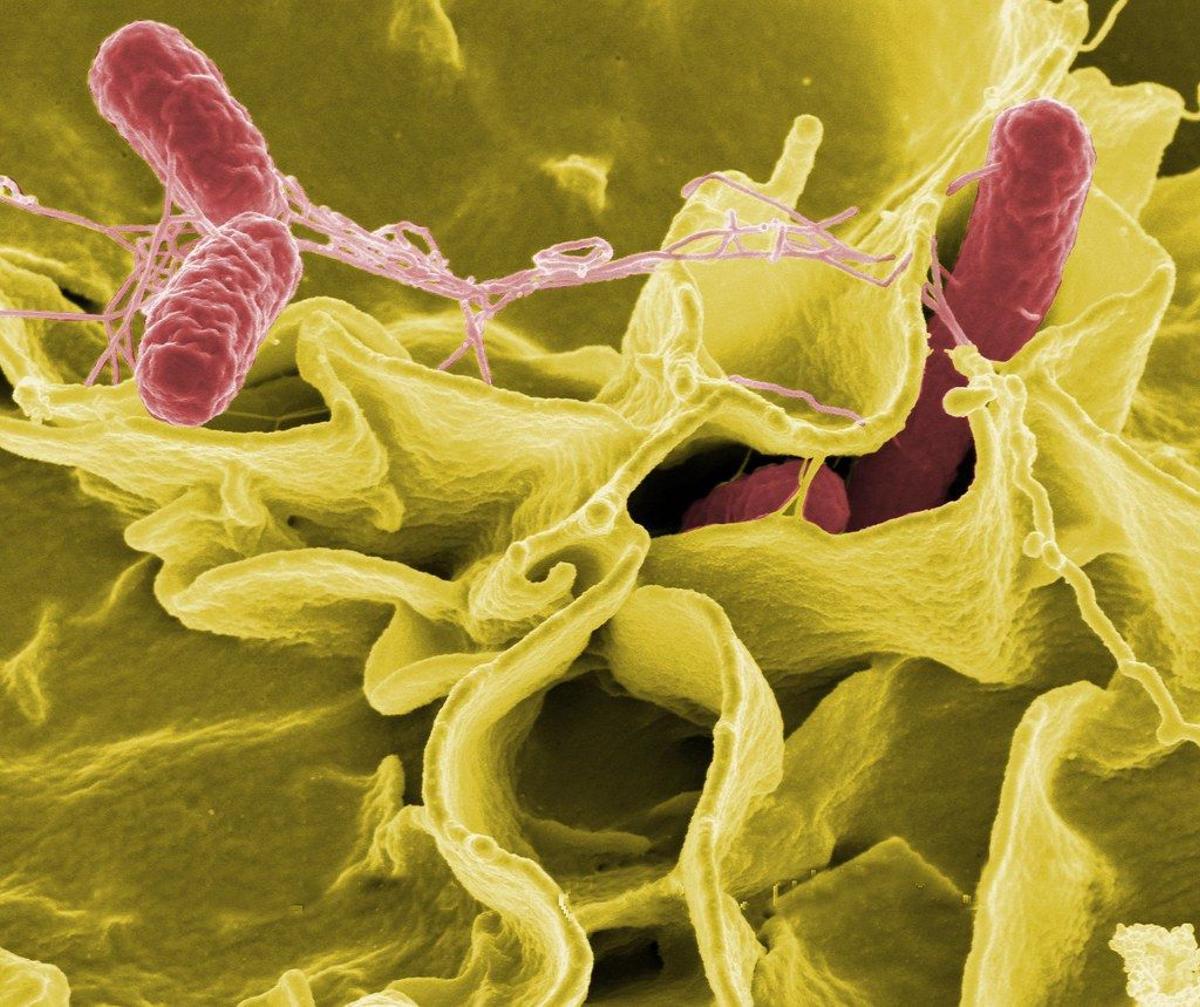 La bacteria Salmonella, causante de la salmonelosis que tanto se dispara en verano