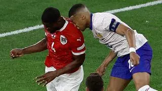 Mbappé se fractura la nariz, pero evita el quirófano y jugará con máscara el resto de la Eurocopa