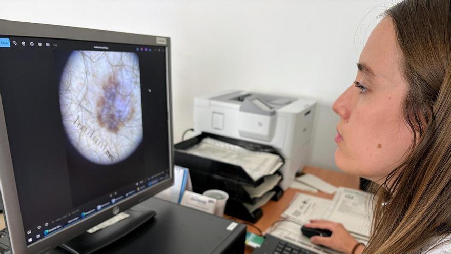El nuevo servicio de teledermatología en Atención Primaria reduce las consultas en el Hospital de Orihuela