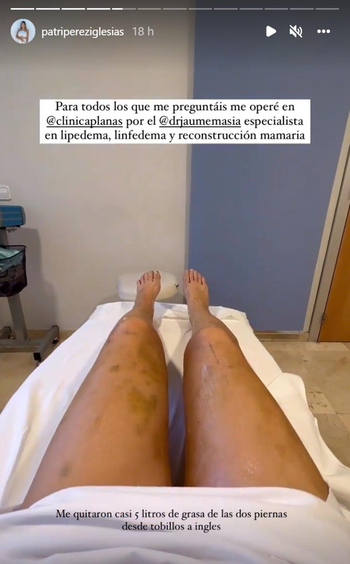 Patri Pérez en quirófano