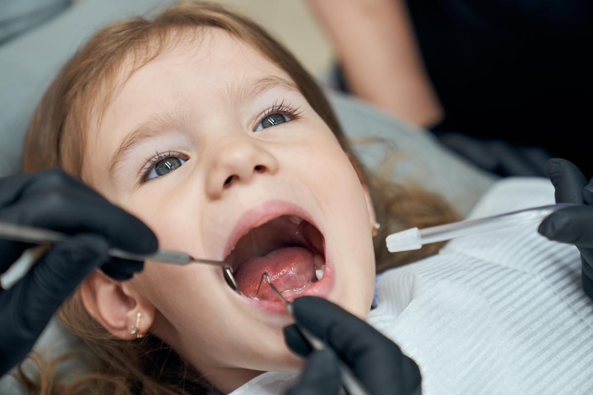 Las caries infantiles, ¿son peligrosas para el corazón? ¿Cómo se pueden evitar?