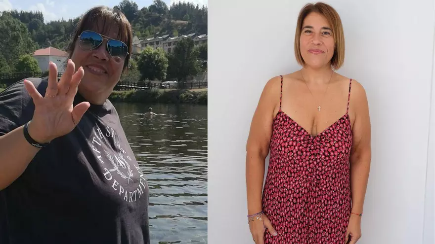 Un día con una alicantina que bajó 55 kilos con cirugía bariátrica