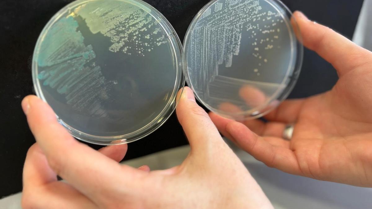 Esta bacteria se detectó en el país por primera vez en el año 1992