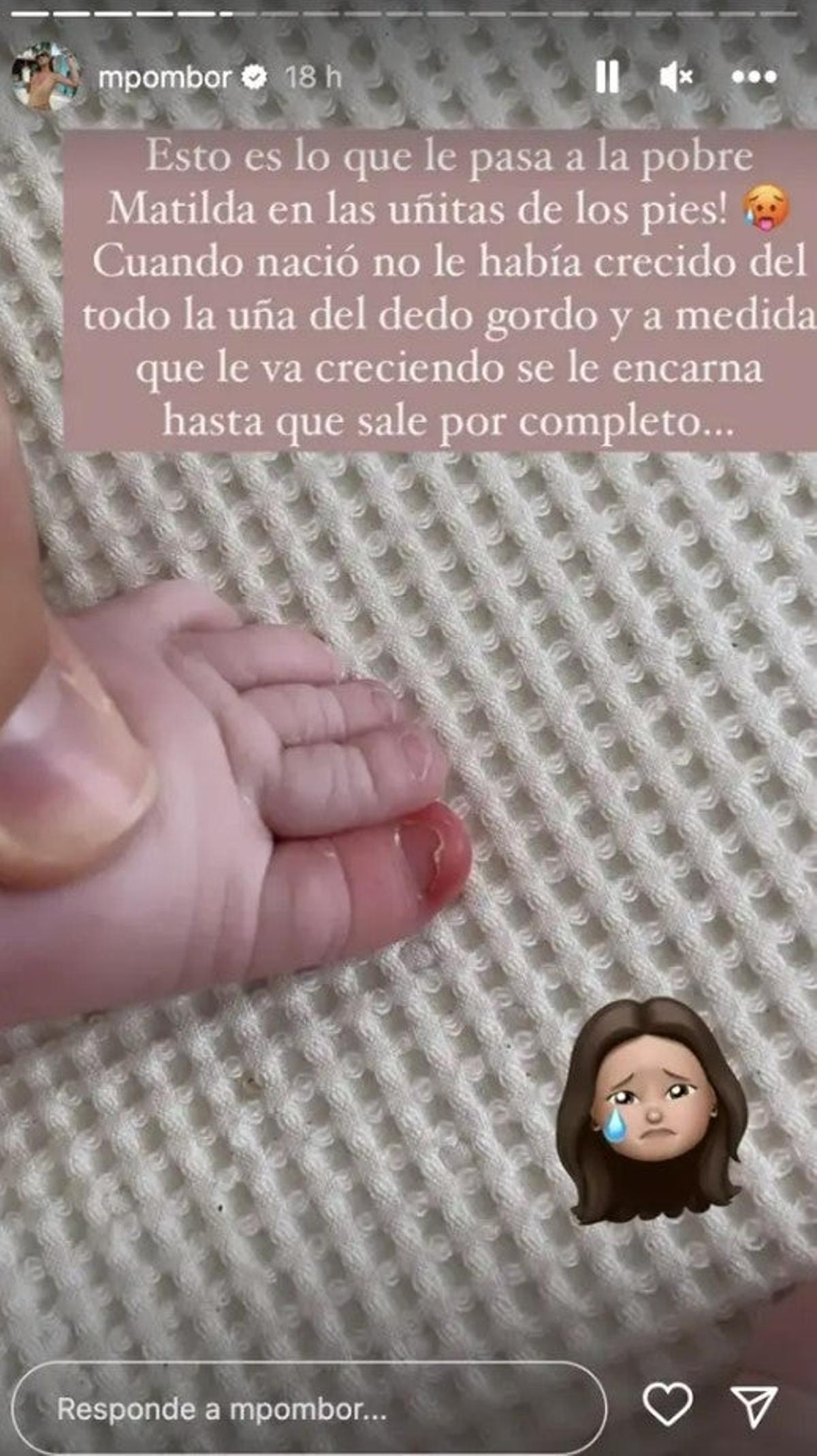 El pie de Matilda, la hija de Marta Pombo