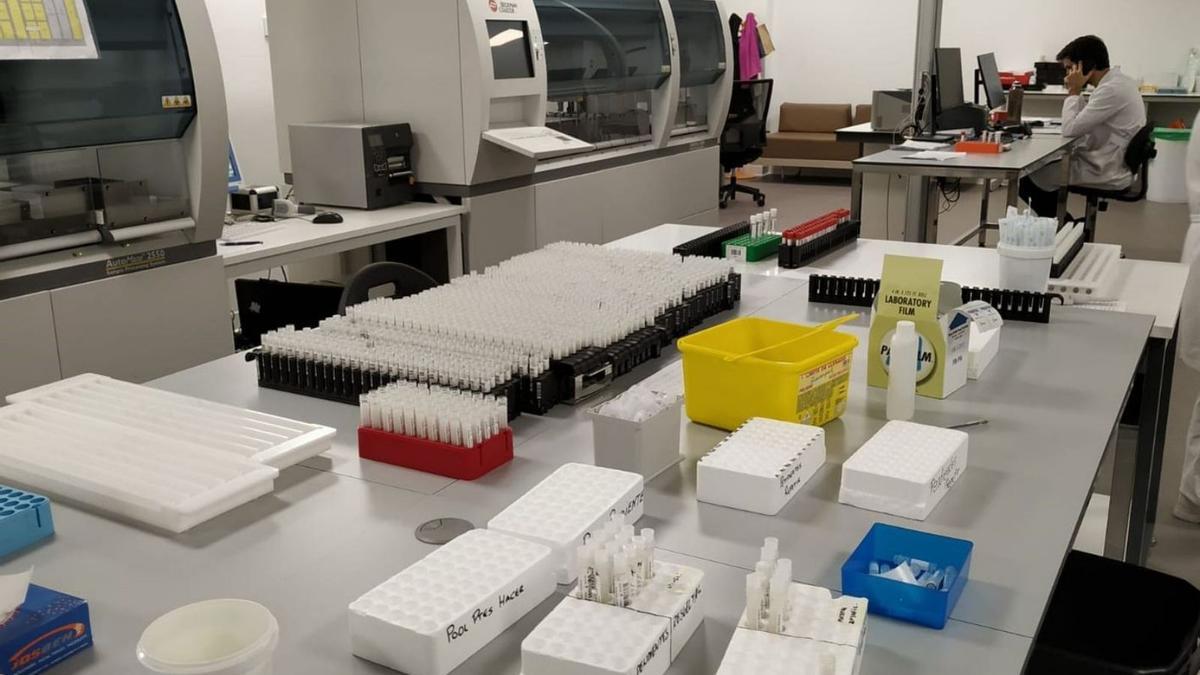 Proves PCRs a punt per analitzar, en una imatge d’arxiu. | EUROPA PRESS