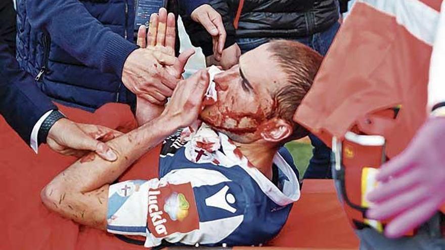 Ãlex BergantiÃ±os sufriÃ³ un profundo corte en el rostro que enmudeciÃ³ a todo Riazor.