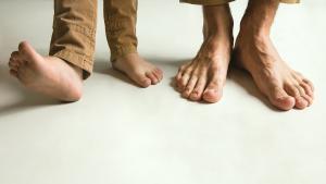 La falta de alineación de los dedos produce problemas al caminar, calzarse y dolor en los pies.