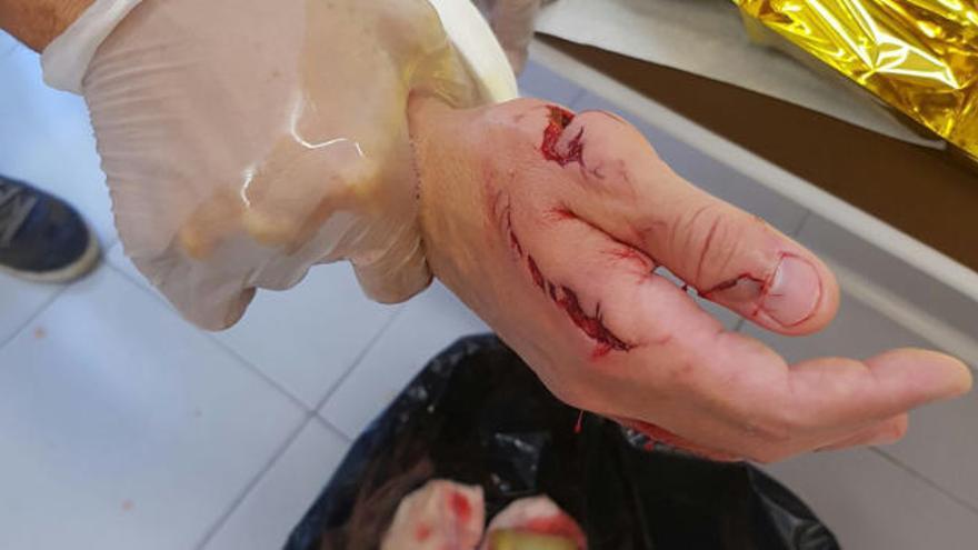 Un tiburón muerde a un bañista en Alicante