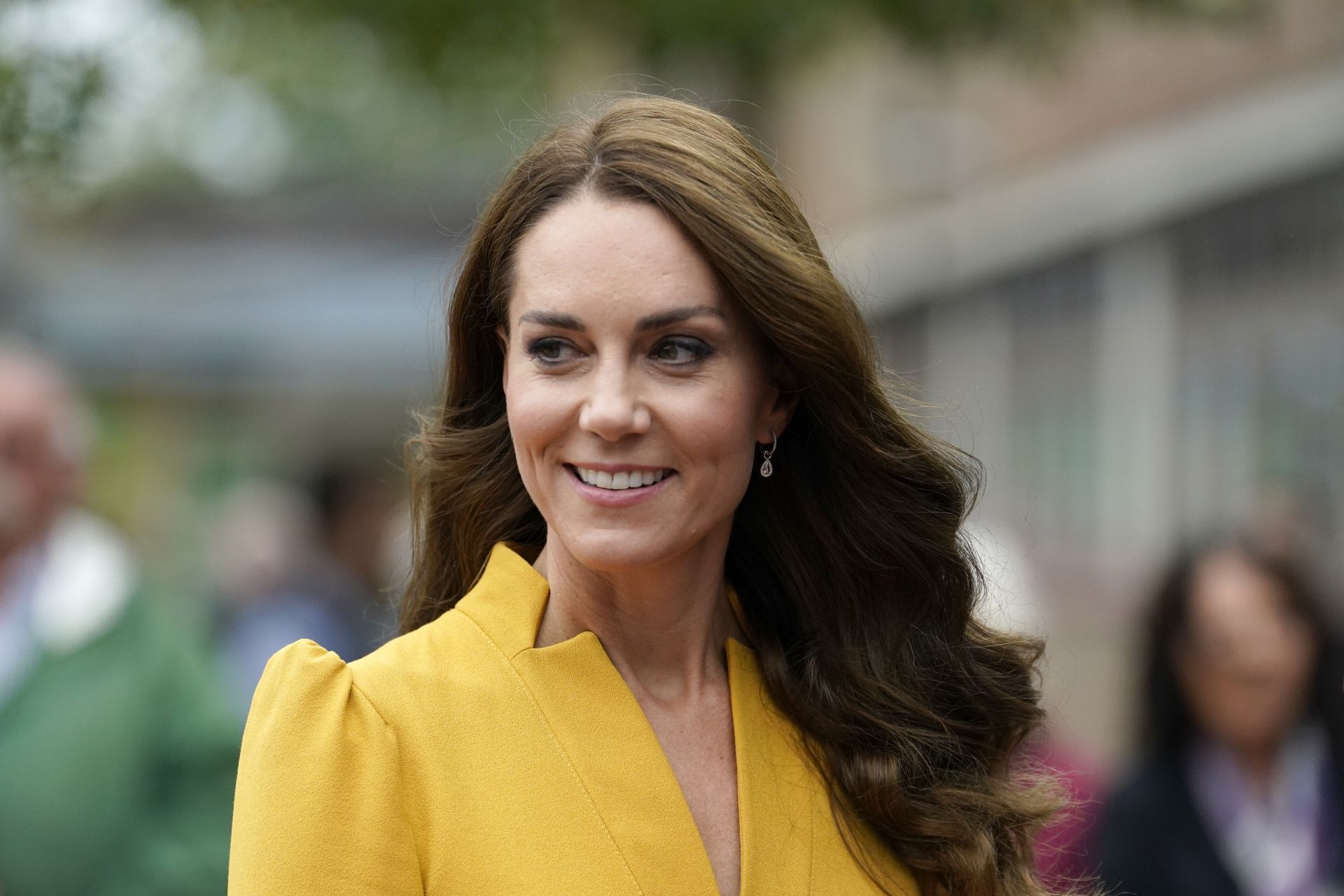 Kate Middleton podría tener diástasis abdominal