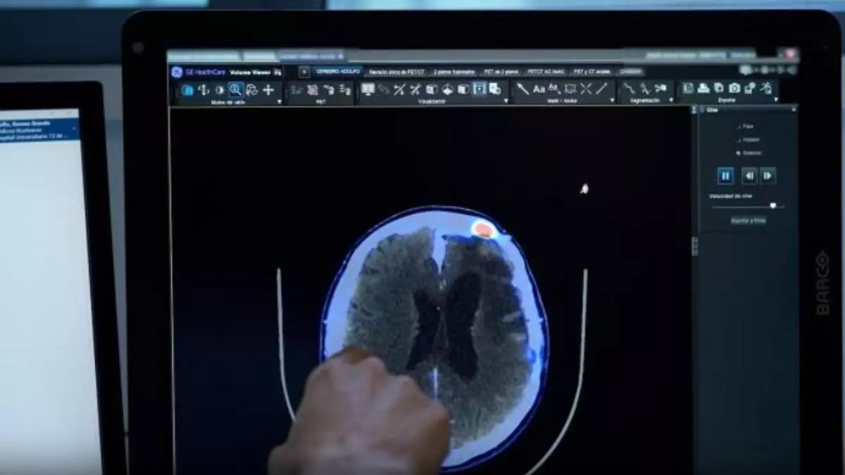 Investigadoras del CEU de Elche crean un modelo pionero para estudiar cómo se originan los tumores más frecuentes alrededor del cerebro