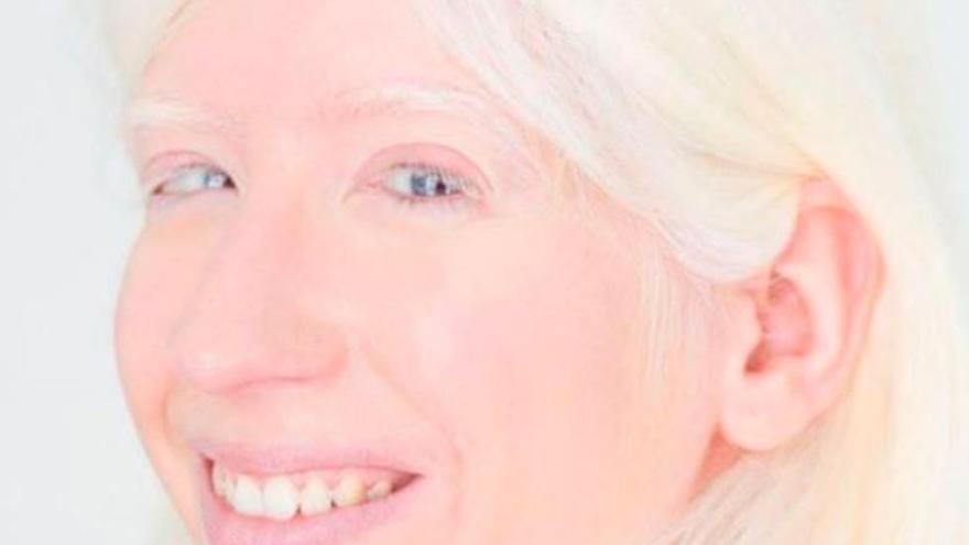 Patty Bonet: &quot;Quiero optar a personajes a los que mi albinismo no los defina&quot;