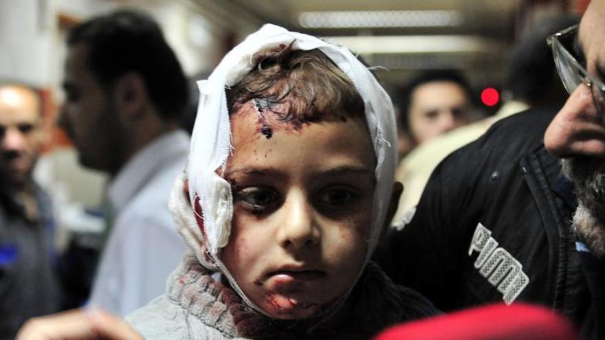 Un niño herido en un ataque en Damasco.