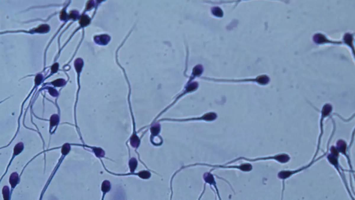 Los microplásticos también llegan al semen.