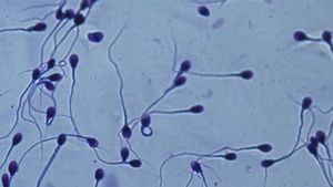 Los microplásticos también llegan al semen.
