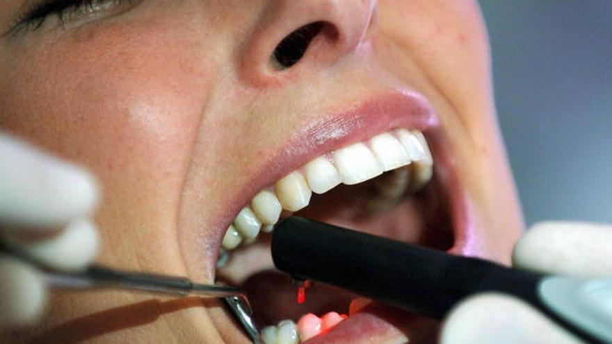 La caries afecta a entre el 80 y 90% de la población mundial