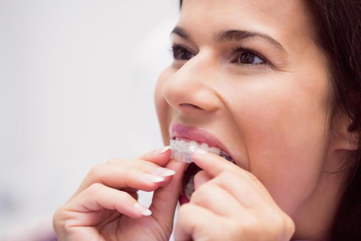 Com mantenir la fèrula dental en perfectes condicions