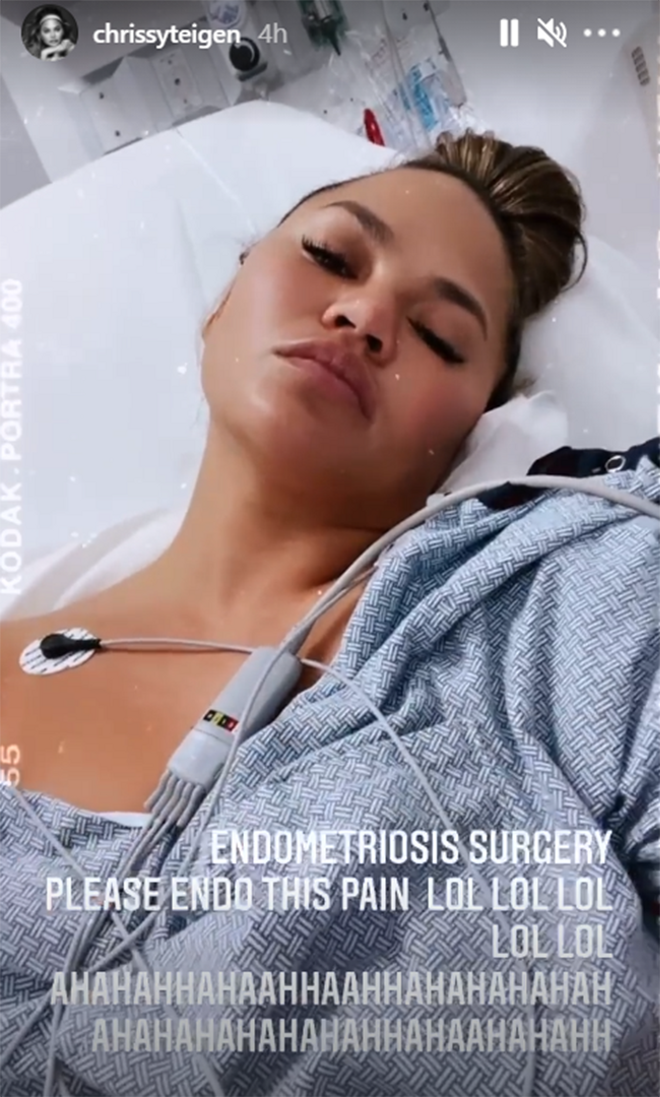 Chrissy Teigen endometriosis