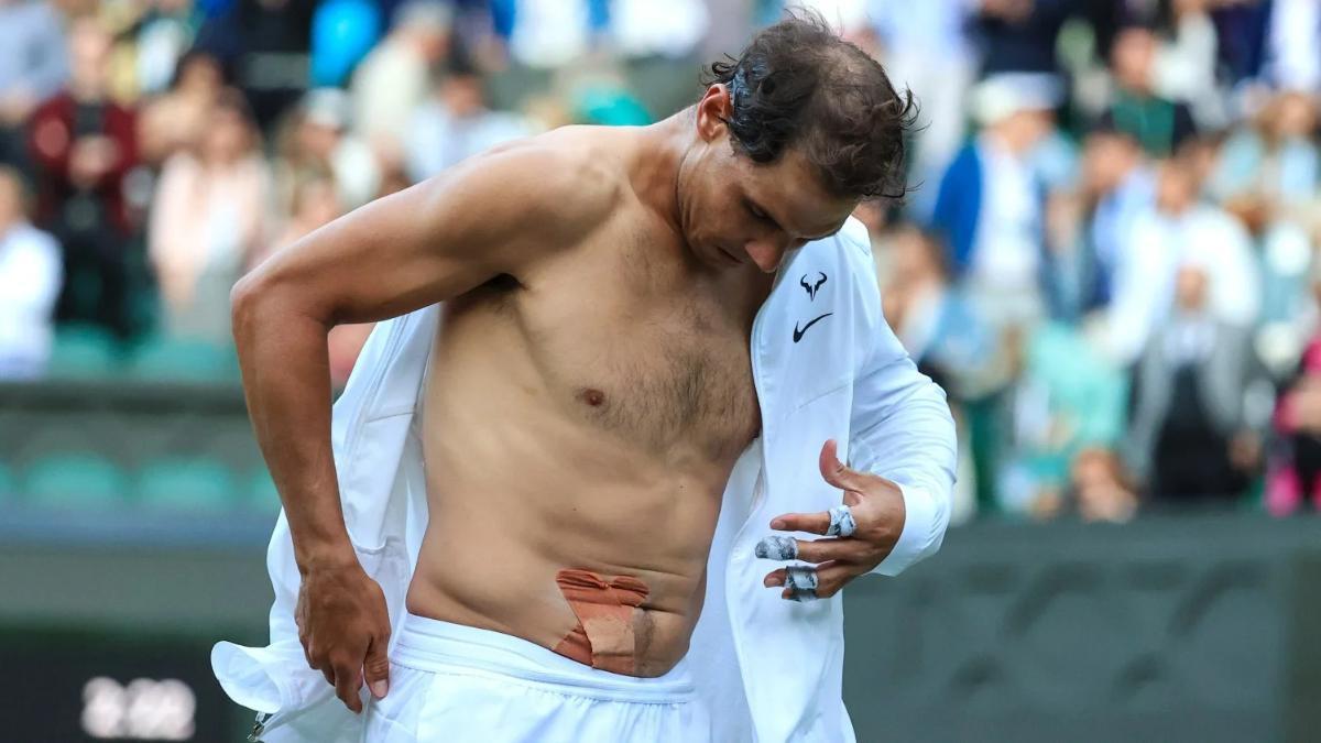 Nadal played with a 7-millimeter tear against Fritz at Wimbledon 2022.