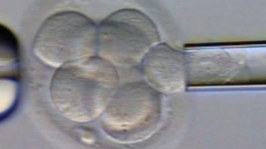 Imagen de archivo de una técnica de reproducción asistida