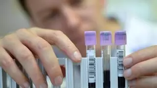 Lucha contra el cáncer de colon: una analítica de sangre puede detectar la enfermedad en sus inicios