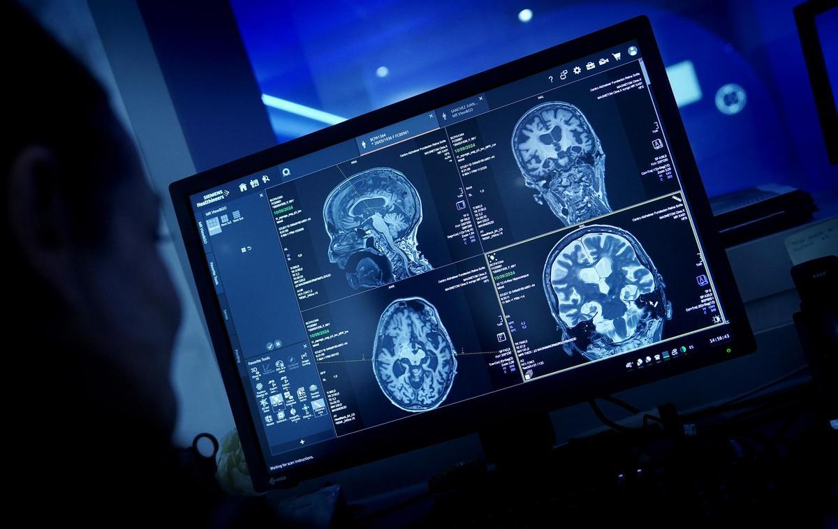 Imagen de archivo de un banco de cerebros donde se estudian enfermedades como el alzhéimer.