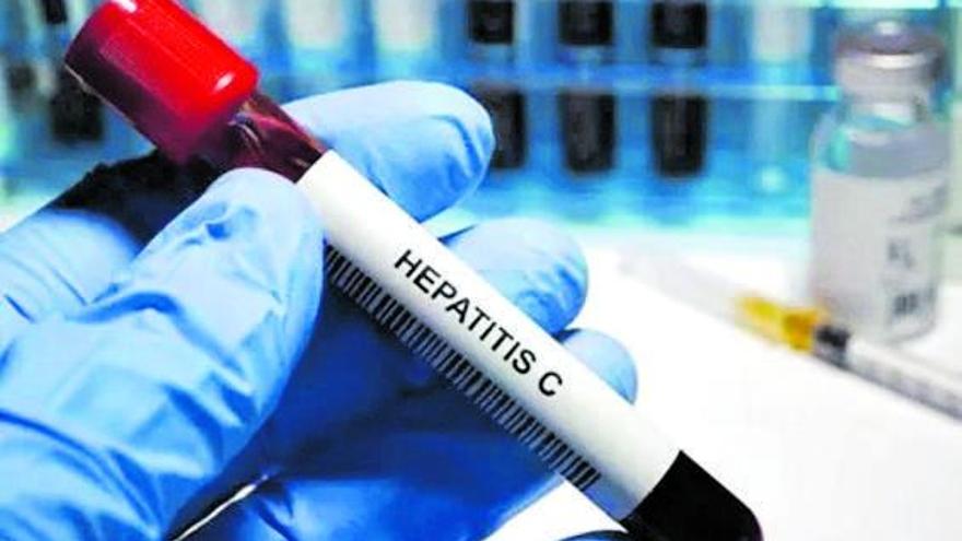 Los casos de hepatitis C continúan en descenso gracias a las nuevas terapias