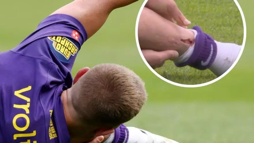 Así ha sido la espeluznante lesión de Lewis Holtby en la Eredivise