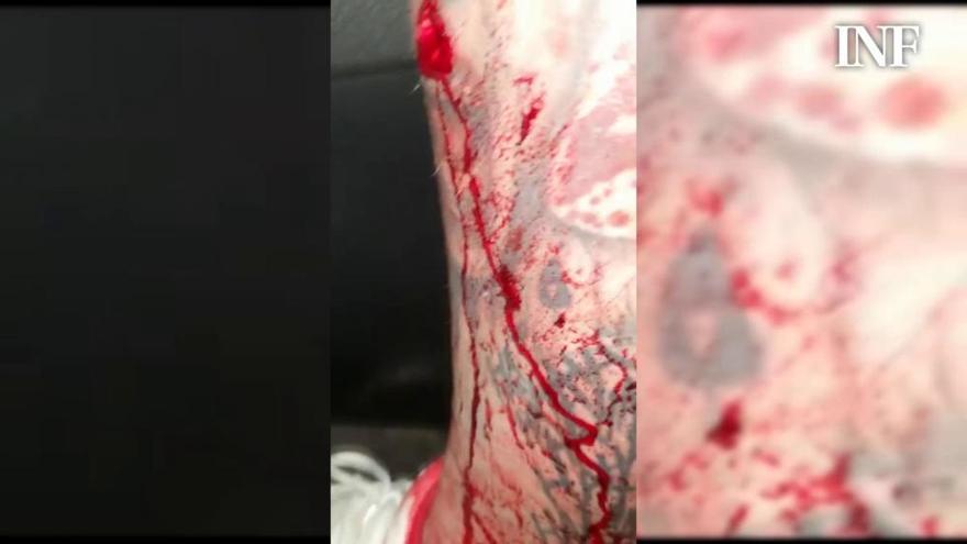 Un herido de bala tras una reyerta en la zona inglesa de Benidorm