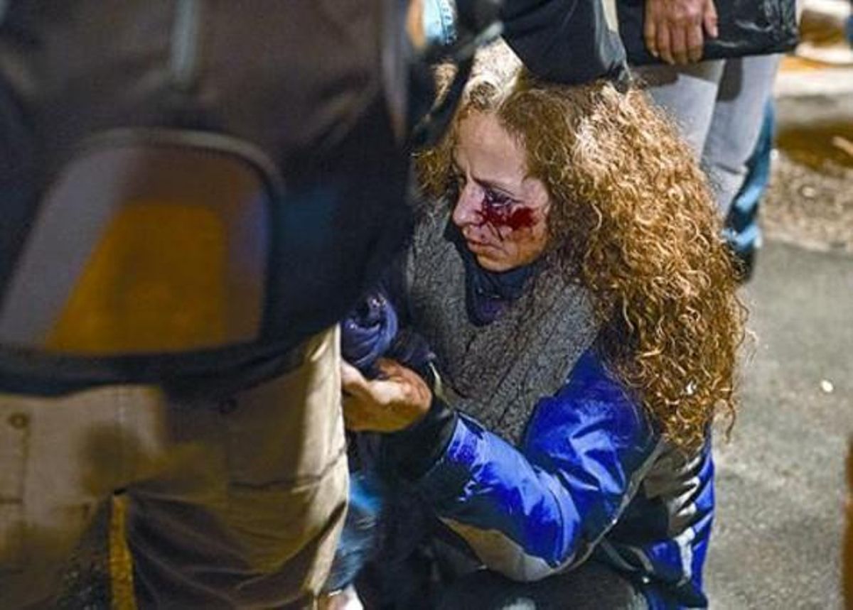 Ester Quintana, durant aquesta entrevista, dilluns, a Barcelona. A baix, la dona després de rebre l’impacte a l’ull, el 14-N. Ester Quintana, durant aquesta entrevista, dilluns, a Barcelona. A baix, la dona després de rebre l’impacte a l’ull, el 14-N.