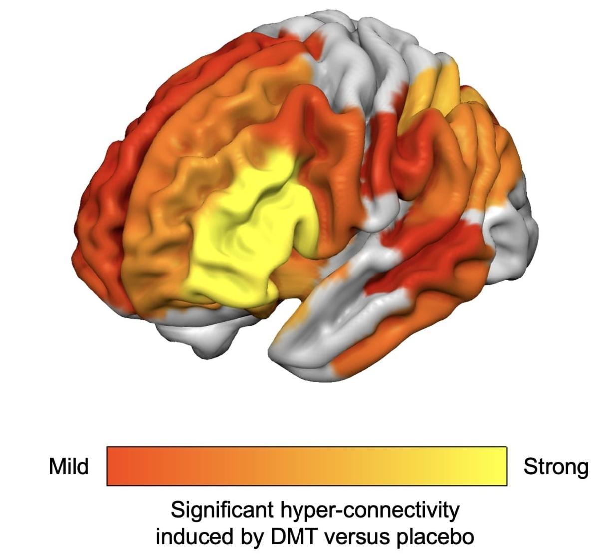 En amarillo se muestran las regiones cerebrales con hiperactividad (en amarillo), tras el consumo de DMT.