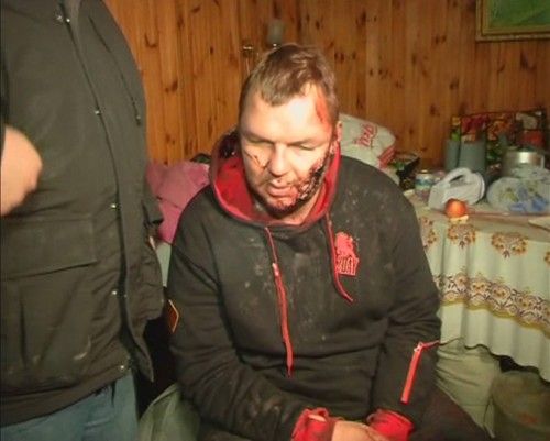 Bulatov, 35, one of the leaders of anti-government protest motorcades called 'Automaidan', speaks to journalists after being found near Kiev