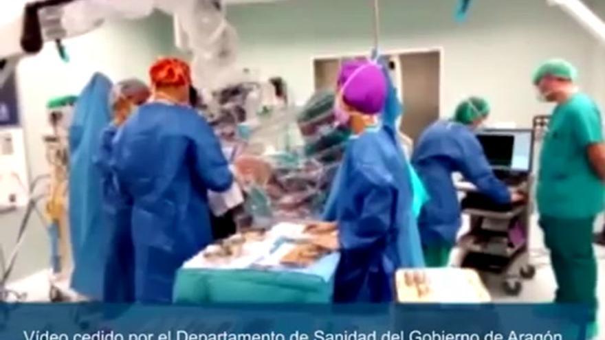 Vídeo de la operación d e a extracción del tumor cerebral