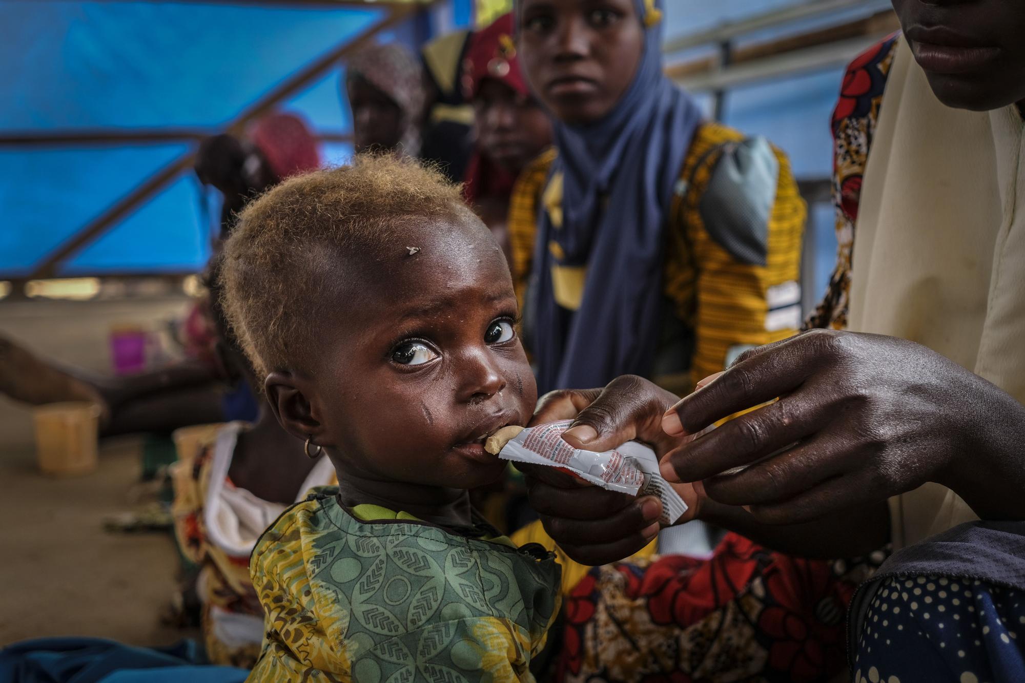 Día Mundial de la Alimentación: ¿Hablamos de la misma historia?