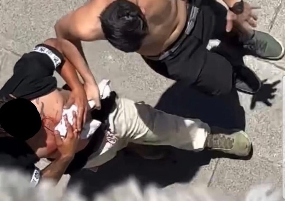 Imagen compartida en Salseo USC de la víctima poco después de la agresión