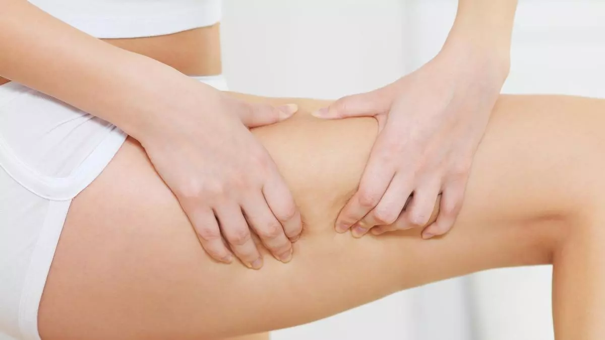 Celulitis: Todo lo que hay que saber sobre la "piel de naranja"... y cómo evitarla