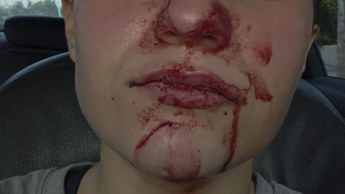 Fotografía que publicó la víctima en su perfil de Instagram tras la agresión.
