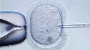 La lista de espera en el Sistema Nacional de Salud (SNS) para un tratamiento de fecundación in vitro es de media de un año.