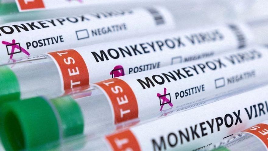 Tubos de ensayo con muestras de la viruela del mono.
