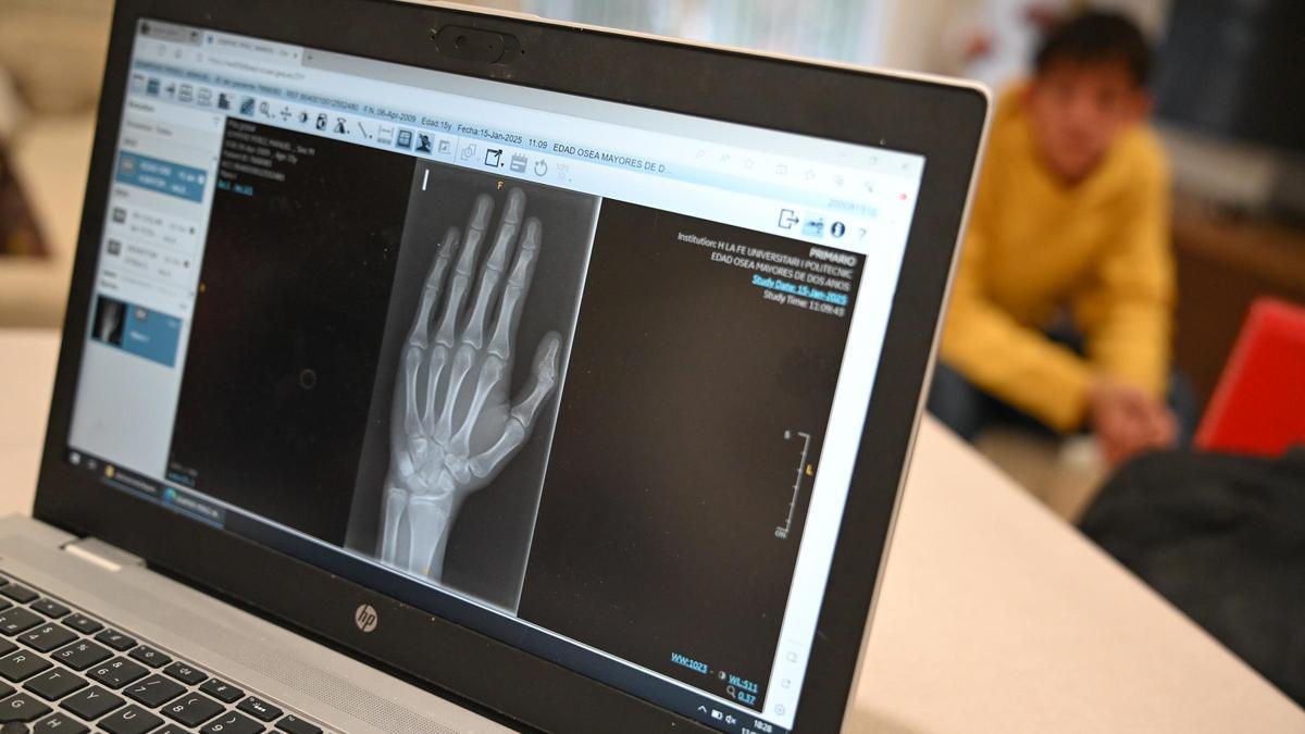 El TSJ fuerza al Hospital General de Elche a dar a un paciente su historial en formato digital al cabo de 6 años El TSJ fuerza al Hospital General de Elche a dar a un paciente su historial en formato digital al cabo de 6 años