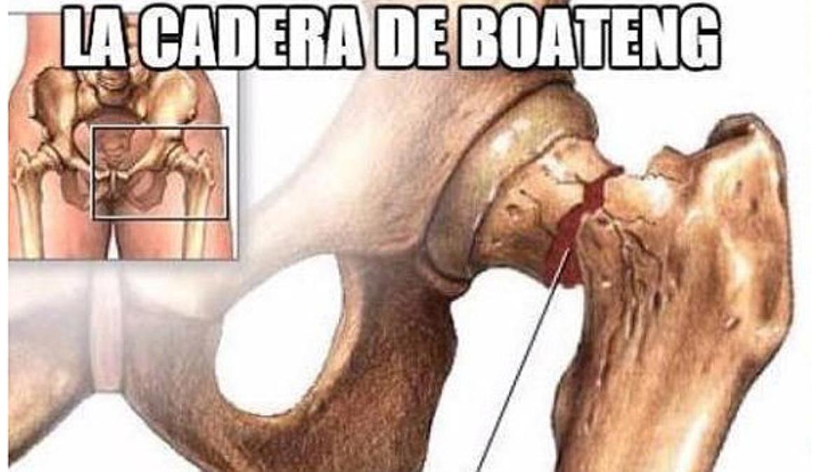 Un meme sobre como ha quedado la cadera de Boateng tras el regate de Messi.
