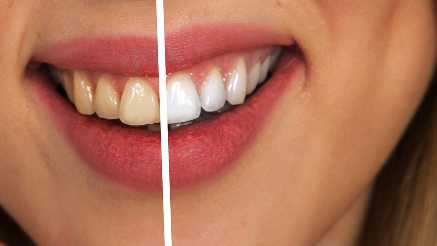 Los remedios caseros para tener los dientes blancos