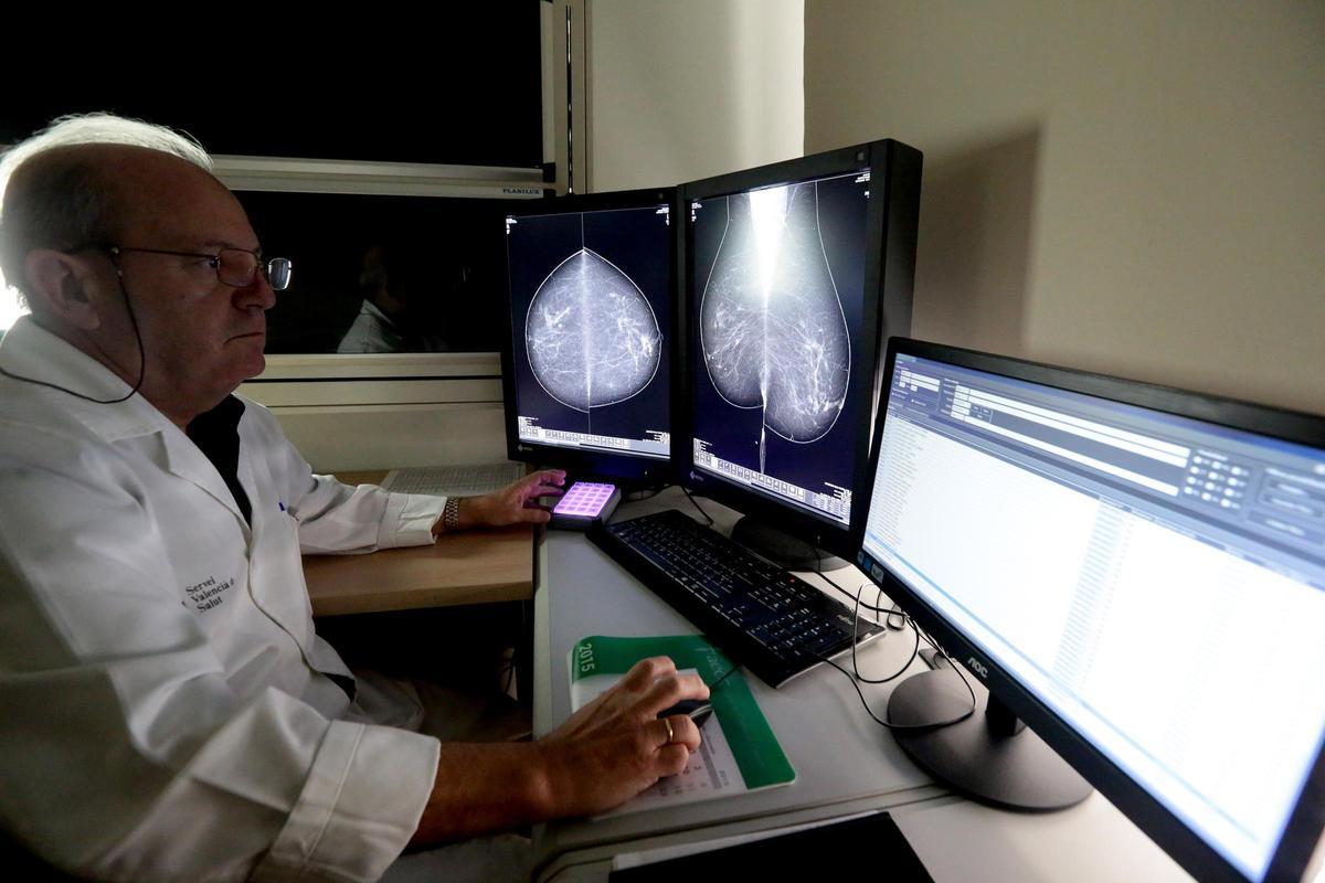 Un radiólogo observa una mamografía en una imagen de archivo